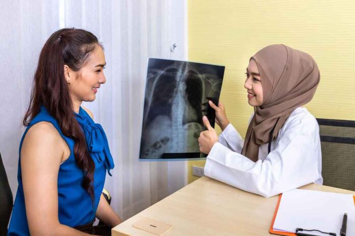 xray of Lung nodules